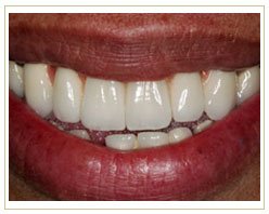 Slider image (5) Dental Retreat